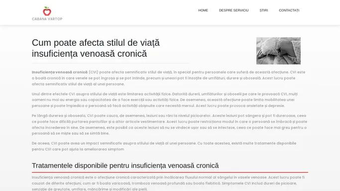 Tratamente pentru Insuficienta Venoasa Cronica - Cum sa Ameliorezi Simptomele si Sa Imbunatatesti Stilul de Viata