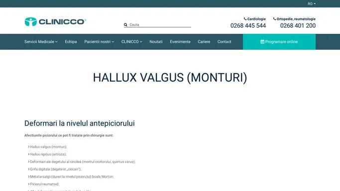 Hallux valgus (monturi) | Spitalul Clinicco